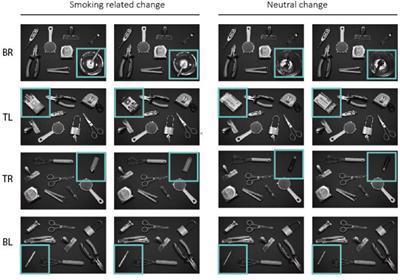The imbalance of self-reported wanting and liking is associated with the degree of attentional bias toward smoking-related stimuli in low nicotine dependence smokers